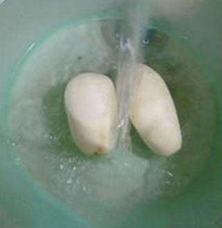 Step image